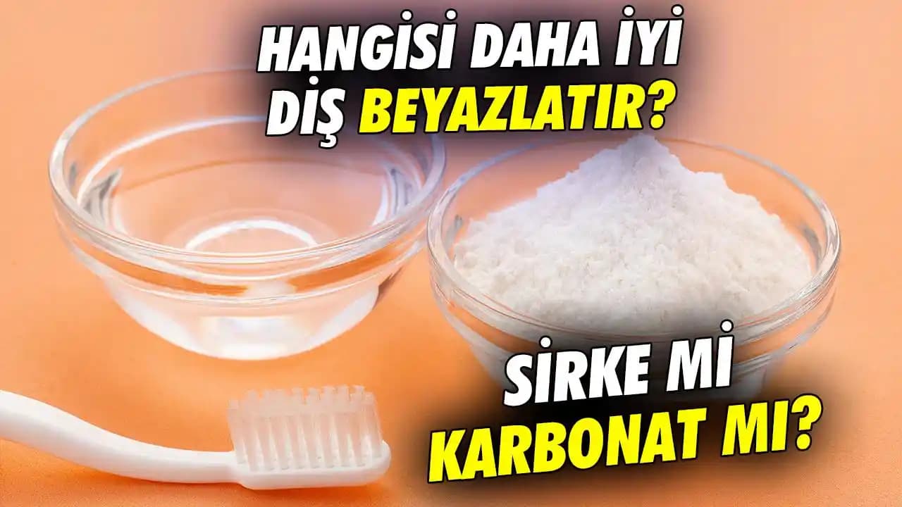 Beyaz Ayakkabıları Karbonat ile Parlatma ve Temizleme Yöntemleri