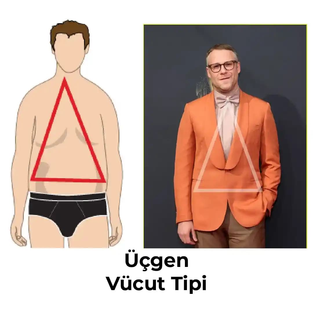 Günlük Moda Soruları ve Stil İpuçları: Vücut Tipi, Kıyafet Uyumu ve Aksesuar Seçimi